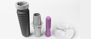 What Are Dental Implants