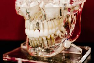 Understanding the Cost of Dental Implants