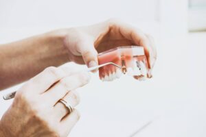 dental implant in Sydney