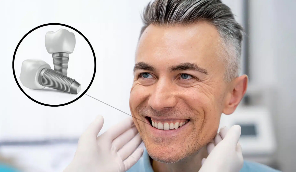 Longevity of Dental Implants - dental implant professionals - sydney