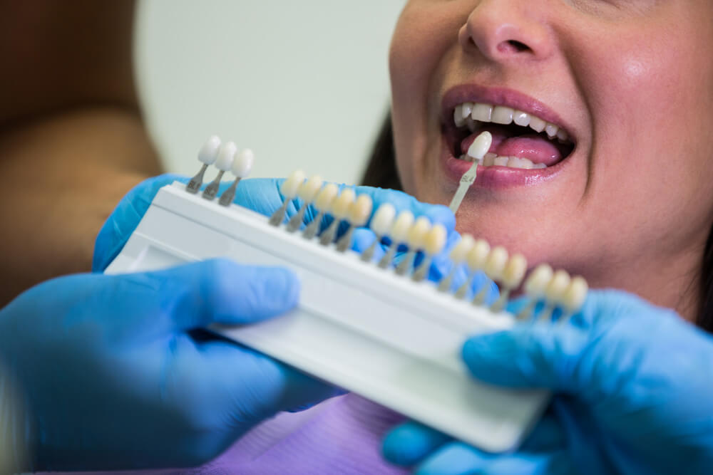 Tooth implants treatment process