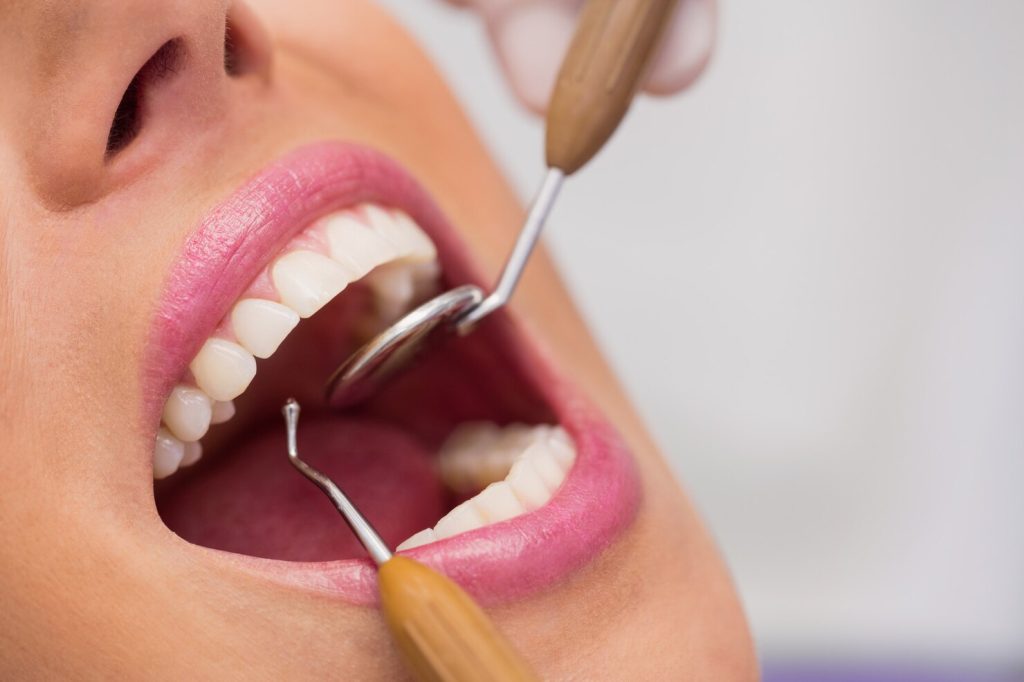 Dentist examining female patient’s teeth during Dental Implants checkup