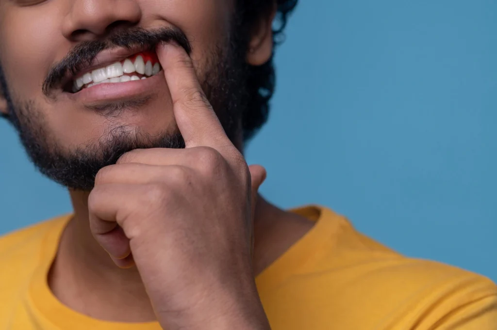 Adult man showing healthy gums after dental implants in Sydney